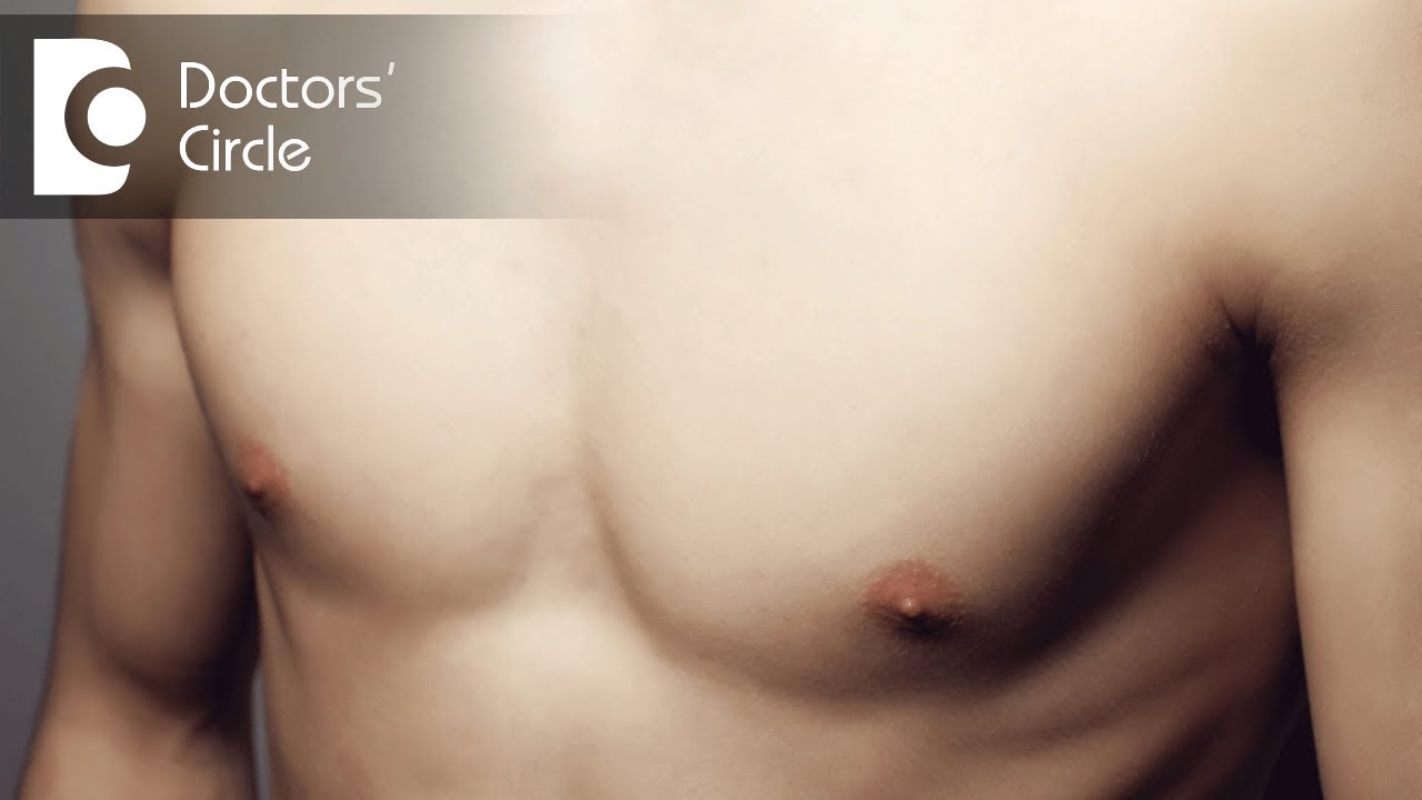 What Is The Difference Between Chest Fat Gynecomastia Dr Surindher D S A Youtube