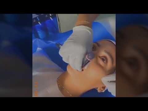 دينا الشربيني بتعمل عملية تجميل بالوجه