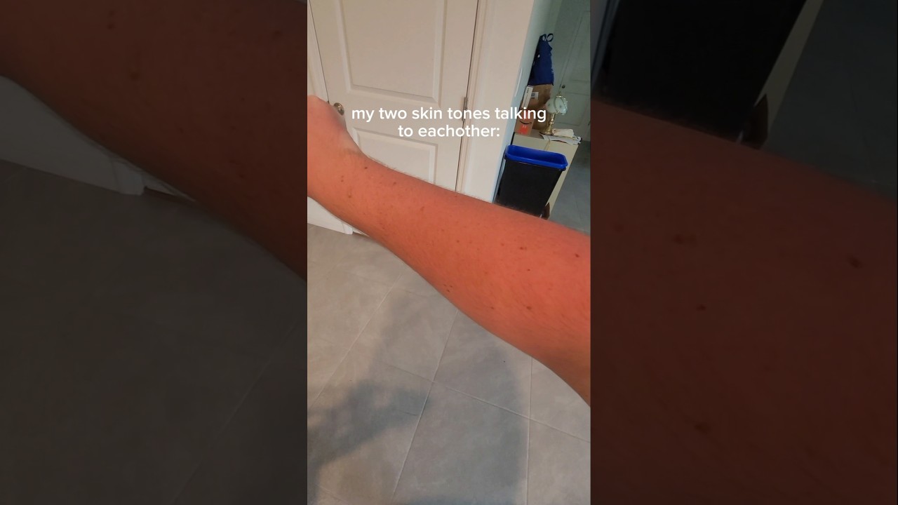 guys I may be a BIT burnt...