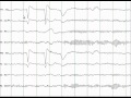 EEG Tutorial