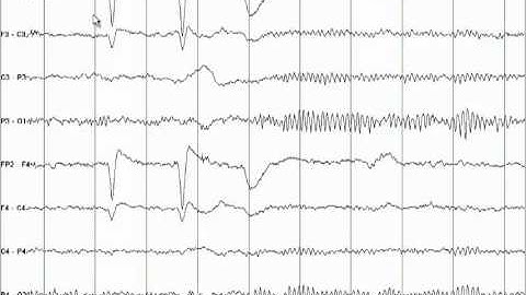 EEG Tutorial