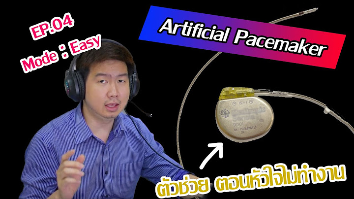 ข อบ งช ของ การใส permanance pacemaker ม ด งน