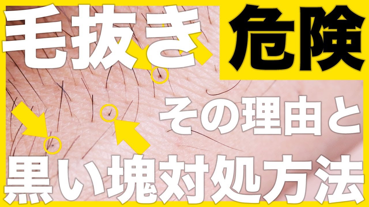 毛抜きで肌荒れしてしまった場合の対処方法 ブツブツ 炎症 色素沈着 エピステ 毛抜きで肌荒れしてしまった場合の対処方法 ブツブツ 炎症 色素沈着 エピステ