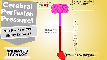 Cerebral Perfusion Pressure (CPP) made easy