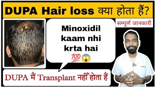 What is DUPA hair loss? Diffused unpatterned alopecia! Do you get results or not?
