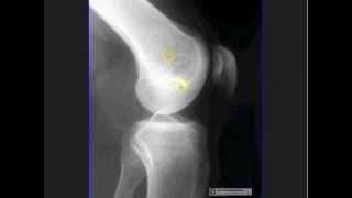 How to Interpret Musculoskeletal Radiographs screenshot 4