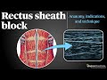 Rectus Sheath Block