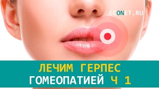 Лечим герпес гомеопатией Ч 1 | ECONET.RU