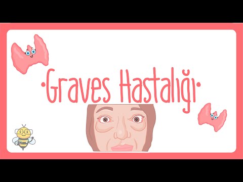 Graves Hastalığı Nedir? | Graves ve Tiroid Hakkında Bilmeniz Gerekenler