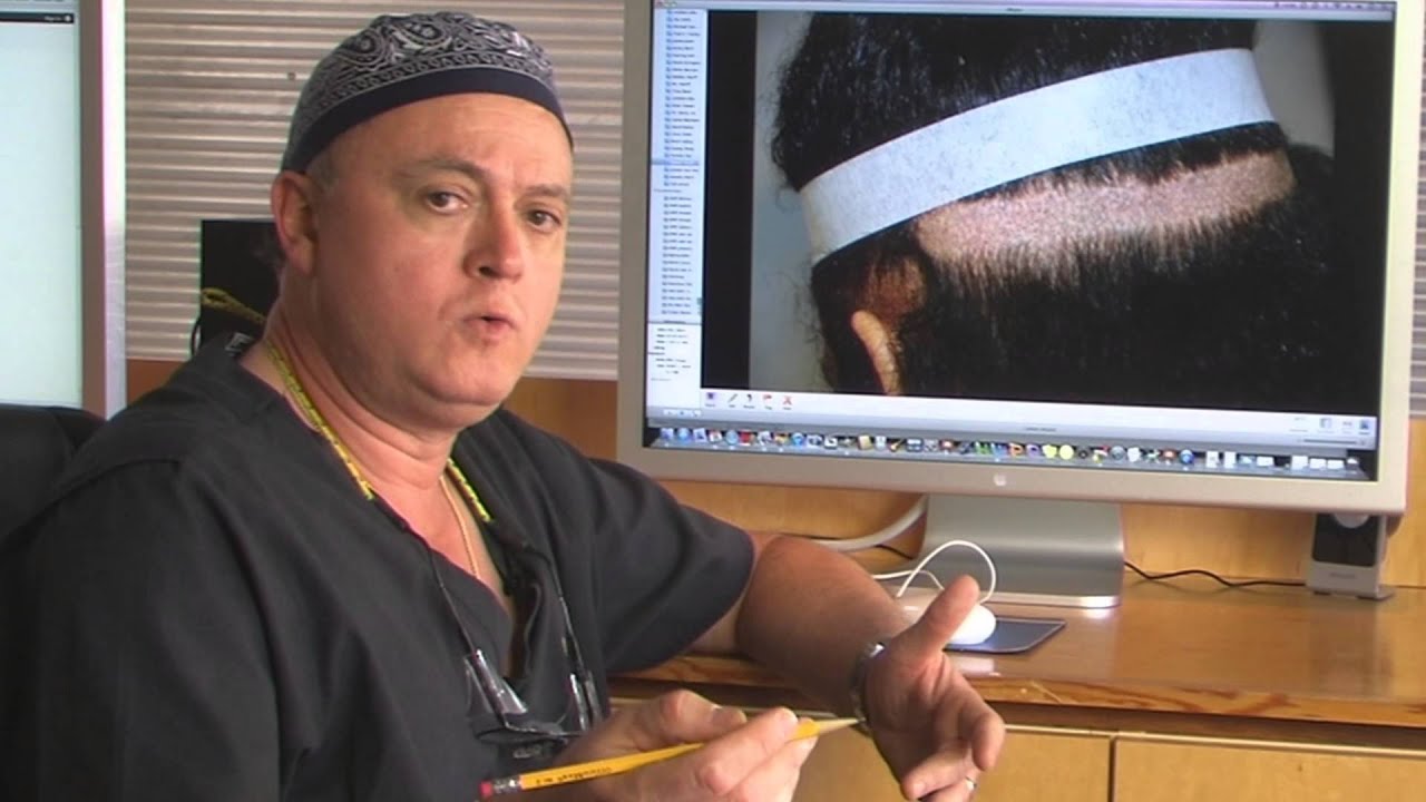 Dr. Bernard Arocha The Facts About Scars YouTube