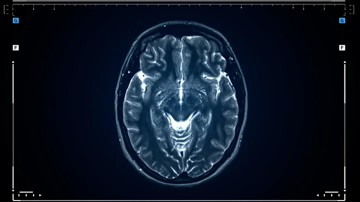 Causes Of Addiction Relapse | QED with Dr. B