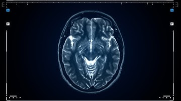 Causes Of Addiction Relapse | QED with Dr. B