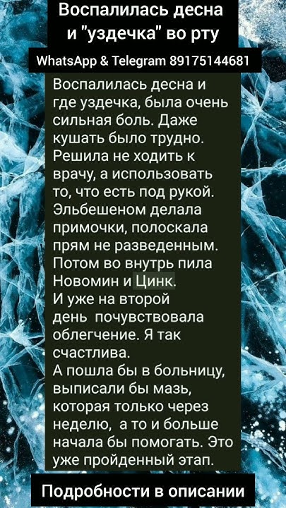 Если воспалилась десна и "уздечка" во рту - YouTube