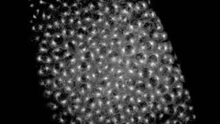 Gfp-Tubulin. Spindle Dynamics In The Early Drosophila Embryo