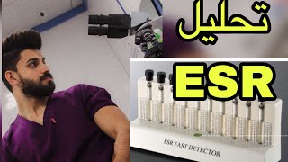 تحليل ال ESR شرح نظري وعملي اشترك في القناة لتصلك باقي الفيديوات