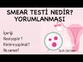 Smear Testinde Reaktif H端creler Inflamasyon Smear Testinin Yorumlanmas脹 Smear Nas脹l Kime Yap脹l脹r Smear Testinde Reaktif H端creler Inflamasyon Smear Testinin Yorumlanmas脹 Smear Nas脹l Kime Yap脹l脹r