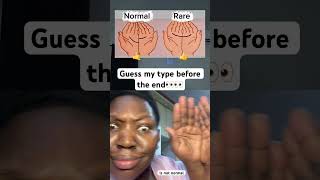 This can’t be normal 👀🙄#shorts