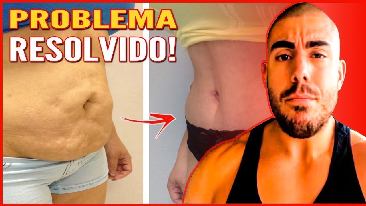 Como eliminar flacidez abdominal, 6 exercícios mais alimentação!