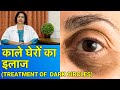 आँखों के काले घेरे / डार्क सर्कल्स का इलाज || Dark Circles Treatment