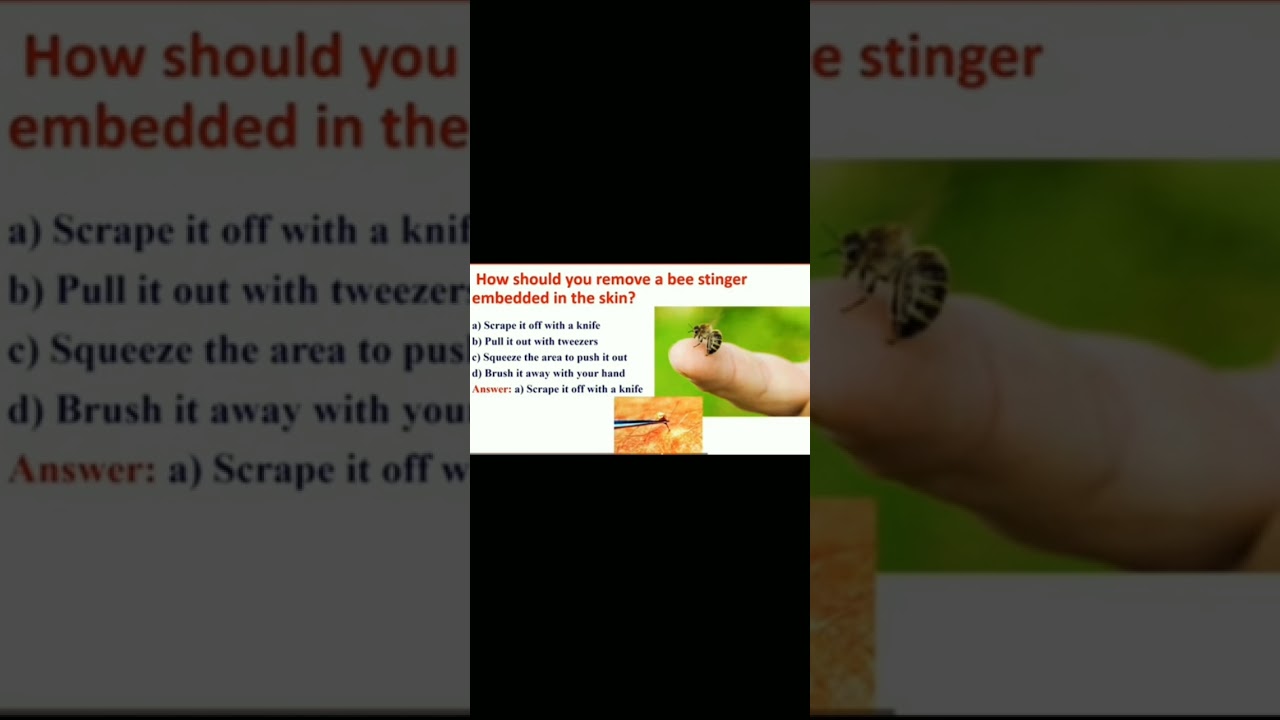 EMT preparation for Central Testing Service 