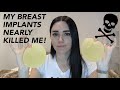 MY BREAST IMPLANTS NEARLY KILLED ME! - Breast Implant Illness story with photos.