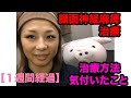 『顔面神経麻痺』治療途中経過