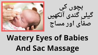 Watery Sticky Eyes of Newborn Babies , Blocked Tear Duct And Sac Massage in Urdu / Hindi