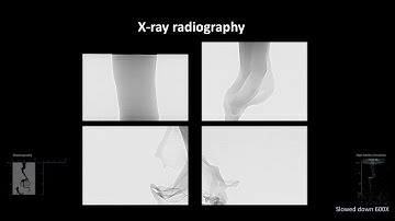 ICLASS 2018 Gallery of Atomization and Sprays - 439