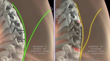 Mobi C vs Fusion   short animation clip