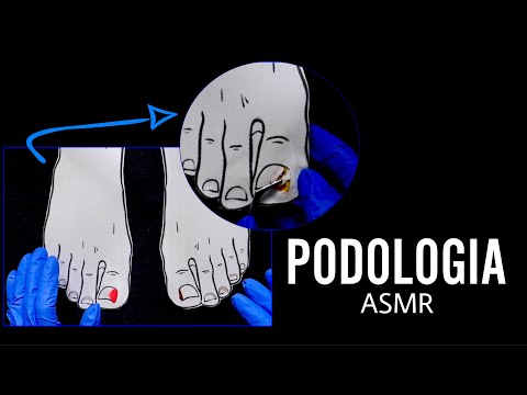 ASMR Portugal: Podologia . unha encravada, fungo, granuloma | Roleplay