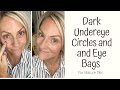 Tips and Tricks for Dark Under Eye Circles and Eye-bags