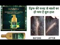 1st Impressions | Indulekha Dandruff Treatment Shampoo | #indulekha #indulekhashampoo