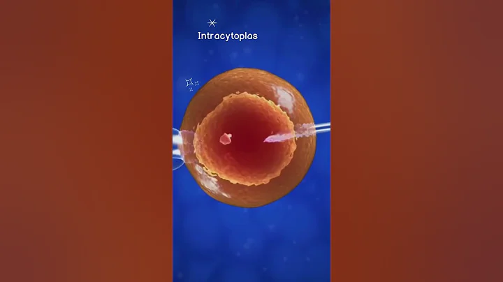 How Invitro Fertilization (IVF) works 😊 #shorts - DayDayNews