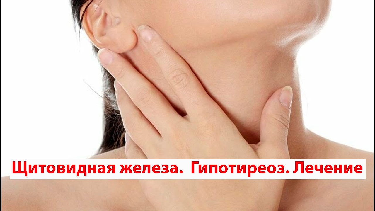 Щитовидная железа. Гипотиреоз. Лечение - YouTube