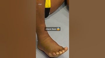 Easier said than done 😱 How do you block those pesky leg kicks? 🤨