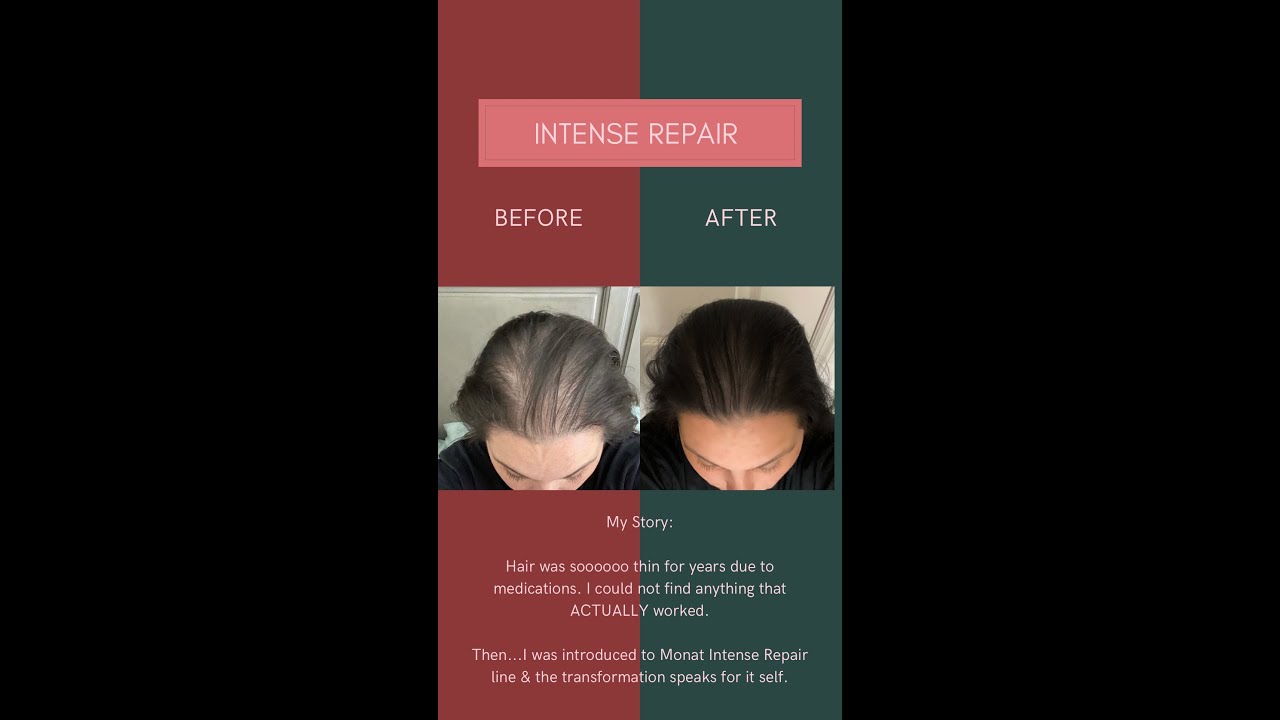 Why I got excited with MONAT for thicker healthy hair