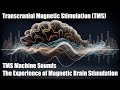 Tms machine sounds the experience of magnetic brain stimulation