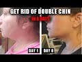 HOW TO GET RID OF A DOUBLE CHIN IN 8 DAYS | IT WORKS FAST!