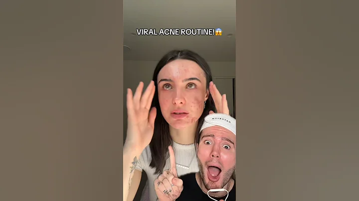VIRAL ACNE ROUTINE!😱 (follow for more!💗) #acne #acnetreatment #beauty #skincare #skincareroutine