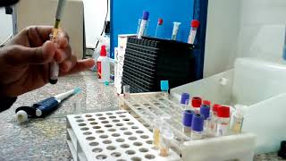 تحليل اليوريا عملي بالدم blood urea test