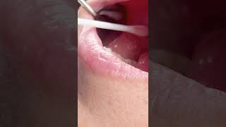 Sabes Qué Es Periolab?