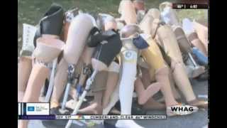 WHAG 10.18.15 Ability Prosthetics & Orthotics Donates 100 Limbs screenshot 3