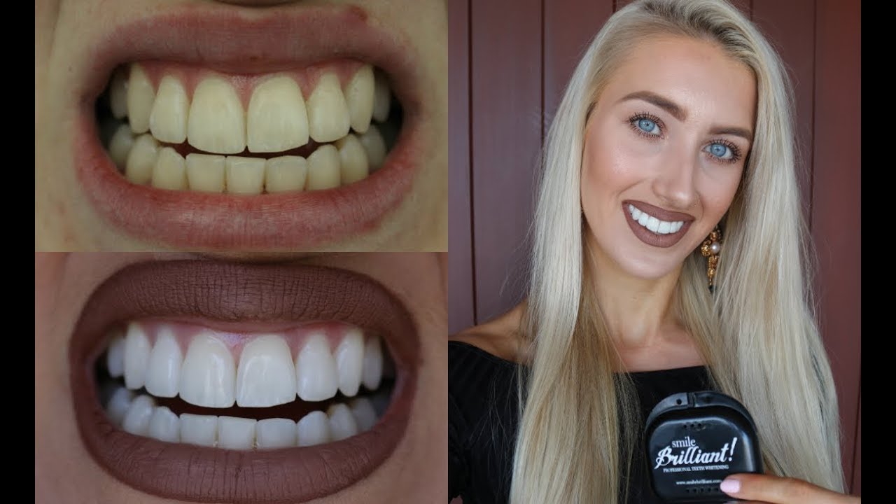 How To Whiten Your Teeth Easily! + SmileBrilliant GIVEAWAY! YouTube