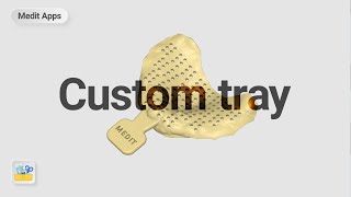 Designing a Custom Tray with Medit Design App screenshot 5