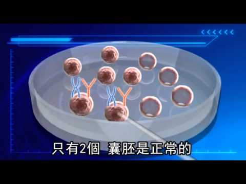 貴婦花千萬挨萬針 胚胎篩檢 成功懷雙胞--蘋果日報20150826