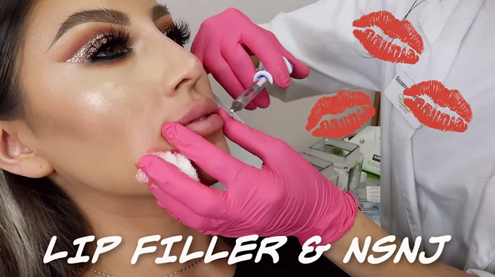 LIP FILLER & NON-SURGICAL NOSE JOB! I EVELYN ARROYO