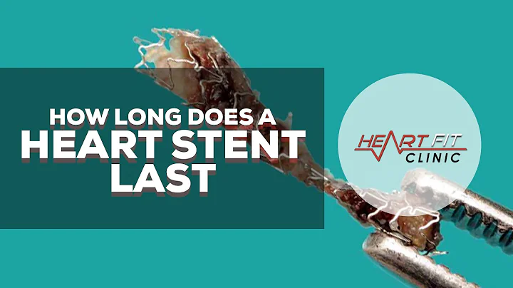 How long does a heart stent last - DayDayNews