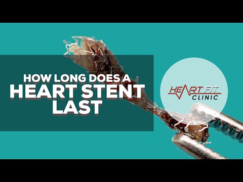 ვიდეო: რამდენი ხანი სჭირდება სტენტს?