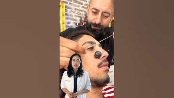 Tẩy nốt ruồi phong cách mới #shorts #tips #bacsiluonghuyen #taynotruoi #fyp  #review