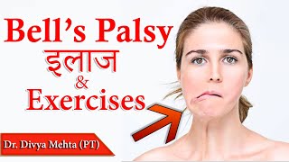 Bells Palsy/Facial Palsy Exercise|| Dr. Divya Mehta (PT)